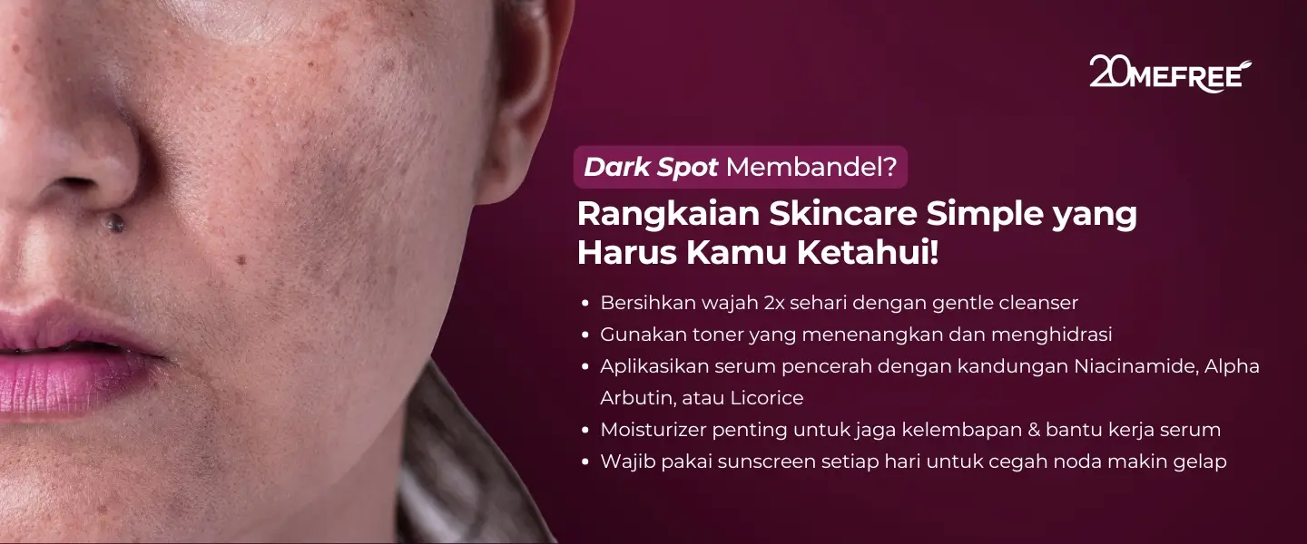 dark-spot-membandel-rangkaian-skincare-simple-yang-harus-kamu-ketahui