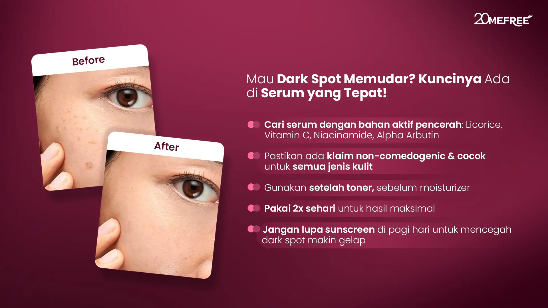 mau-dark-spot-memudar-kuncinya-ada-di-serum-yang-tepat