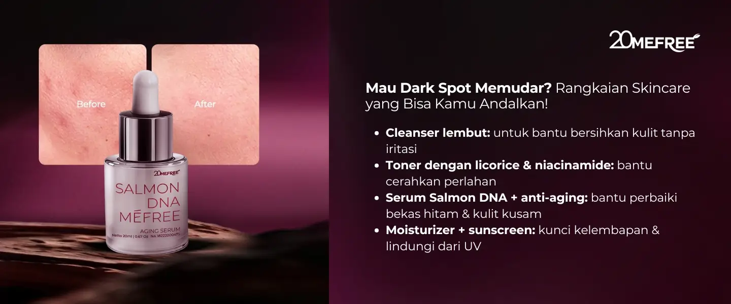 mau-dark-spot-memudar-rangkaian-skincare-yang-bisa-kamu-andalkan